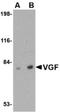 VGF Nerve Growth Factor Inducible antibody, orb88324, Biorbyt, Western Blot image 