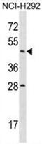 Actin Like 7B antibody, AP50070PU-N, Origene, Western Blot image 