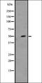 NK2 Homeobox 5 antibody, orb335509, Biorbyt, Western Blot image 