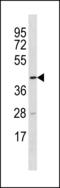 Tetratricopeptide repeat protein 5 antibody, LS-C203868, Lifespan Biosciences, Western Blot image 