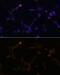 Ubiquitin Conjugating Enzyme E2 L6 antibody, GTX66195, GeneTex, Immunocytochemistry image 