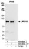 La-related protein 4B antibody, A304-622A, Bethyl Labs, Immunoprecipitation image 