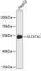Solute Carrier Family 47 Member 1 antibody, 23-860, ProSci, Western Blot image 
