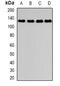 Dishevelled Associated Activator Of Morphogenesis 2 antibody, abx141986, Abbexa, Western Blot image 