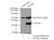 Pyrroline-5-Carboxylate Reductase 2 antibody, 17146-1-AP, Proteintech Group, Immunoprecipitation image 