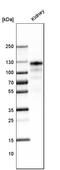 Angiotensin I Converting Enzyme 2 antibody, AMAb91262, Atlas Antibodies, Western Blot image 