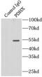 Pyruvate Dehydrogenase Complex Component X antibody, FNab06271, FineTest, Immunoprecipitation image 