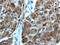 Protein Inhibitor Of Activated STAT 3 antibody, 13486-1-AP, Proteintech Group, Immunohistochemistry paraffin image 