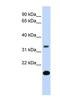 Follistatin antibody, NBP1-57997, Novus Biologicals, Western Blot image 