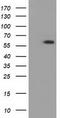 Pantothenate kinase 2, mitochondrial antibody, TA501419S, Origene, Western Blot image 
