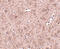 Ceramide Synthase 6 antibody, 4941, ProSci Inc, Immunohistochemistry paraffin image 