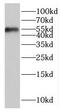 Inositol-Trisphosphate 3-Kinase A antibody, FNab04422, FineTest, Western Blot image 