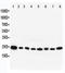RAB8A, Member RAS Oncogene Family antibody, LS-C313375, Lifespan Biosciences, Western Blot image 