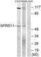 Serine And Arginine Rich Splicing Factor 11 antibody, LS-C120417, Lifespan Biosciences, Western Blot image 