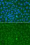 Microsomal triglyceride transfer protein large subunit antibody, orb48462, Biorbyt, Immunocytochemistry image 