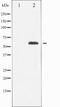 Tubulin Beta 3 Class III antibody, TA327902, Origene, Western Blot image 
