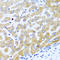C-C Motif Chemokine Ligand 21 antibody, LS-C331756, Lifespan Biosciences, Immunohistochemistry paraffin image 