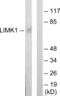 LIM Domain Kinase 1 antibody, abx013534, Abbexa, Western Blot image 