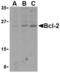 BCL2 antibody, TA306171, Origene, Western Blot image 