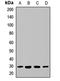 ELL Associated Factor 2 antibody, LS-C668799, Lifespan Biosciences, Western Blot image 
