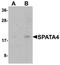 Spermatogenesis-associated protein 4 antibody, orb75684, Biorbyt, Western Blot image 