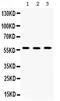 Chaperonin Containing TCP1 Subunit 2 antibody, PA5-78952, Invitrogen Antibodies, Western Blot image 