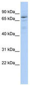 Hypermethylated in cancer 1 protein antibody, TA343615, Origene, Western Blot image 