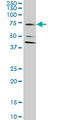 Excitatory amino acid transporter 2 antibody, LS-C139168, Lifespan Biosciences, Western Blot image 