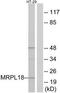 Mitochondrial Ribosomal Protein L18 antibody, TA315391, Origene, Western Blot image 