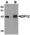 Solute Carrier Family 39 Member 12 antibody, TA320147, Origene, Western Blot image 