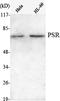 Jumonji Domain Containing 6, Arginine Demethylase And Lysine Hydroxylase antibody, A03690, Boster Biological Technology, Western Blot image 