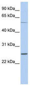 Sodium channel subunit beta-1 antibody, TA338513, Origene, Western Blot image 