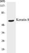 Keratin 8 antibody, EKC1328, Boster Biological Technology, Western Blot image 