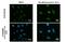 ATR Serine/Threonine Kinase antibody, GTX128145, GeneTex, Immunofluorescence image 