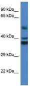 Reticulon 4 Interacting Protein 1 antibody, TA343013, Origene, Western Blot image 