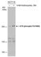 ATR Serine/Threonine Kinase antibody, PA5-77873, Invitrogen Antibodies, Western Blot image 