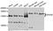 DExH-Box Helicase 30 antibody, STJ111310, St John
