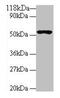 Glucagon-like peptide 1 receptor antibody, CSB-PA009514LA01HU, Cusabio, Western Blot image 