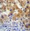 5'-Nucleotidase, Cytosolic IIIB antibody, LS-C163030, Lifespan Biosciences, Immunohistochemistry frozen image 