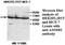 Anti-Mullerian Hormone Receptor Type 2 antibody, MBS415610, MyBioSource, Western Blot image 