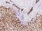 Keratin, type II cytoskeletal 8 antibody, 108772-MM04, Sino Biological, Immunohistochemistry frozen image 