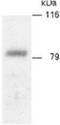 ADAM Metallopeptidase Domain 9 antibody, TA352958L, Origene, Western Blot image 