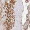 Zinc Finger CCCH-Type Containing 11A antibody, HPA028526, Atlas Antibodies, Immunohistochemistry frozen image 