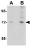 Rho GTPase-activating protein 18 antibody, GTX85208, GeneTex, Western Blot image 