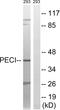 Peroxisomal 3,2-trans-enoyl-CoA isomerase antibody, A30744, Boster Biological Technology, Western Blot image 