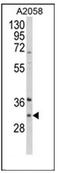 Inhibitor of growth protein 5 antibody, AP52210PU-N, Origene, Western Blot image 