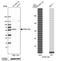 ATPase H+ Transporting V1 Subunit B2 antibody, NBP1-88890, Novus Biologicals, Western Blot image 