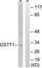Glutathione S-transferase theta-1 antibody, TA313305, Origene, Western Blot image 