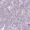 Small Integral Membrane Protein 11A antibody, HPA051321, Atlas Antibodies, Immunohistochemistry paraffin image 