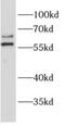 ALG6 Alpha-1,3-Glucosyltransferase antibody, FNab00308, FineTest, Western Blot image 